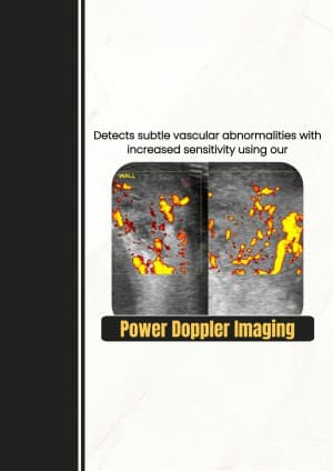 3D-4D USG Color Doppler video