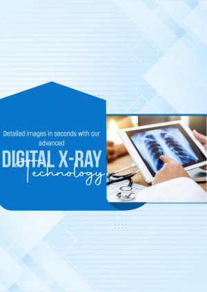 Digital X-Ray template