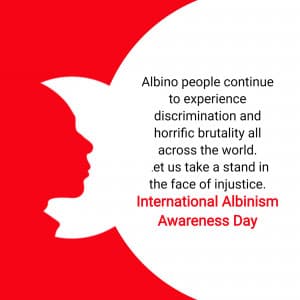 International Albinism Awareness Day creative image