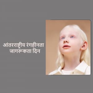 International Albinism Awareness Day greeting image