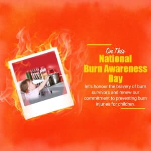 National Burn Awareness Day - UK image