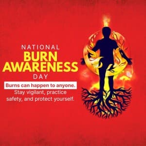 National Burn Awareness Day - UK banner