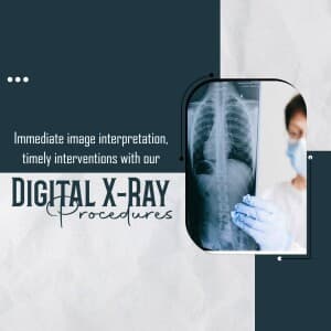 Digital X-Ray image